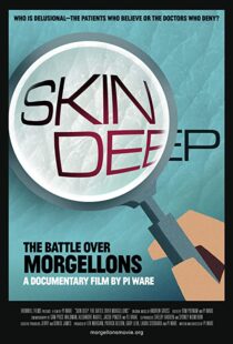 دانلود مستند Skin Deep: The Battle Over Morgellons 2019104233-733278921